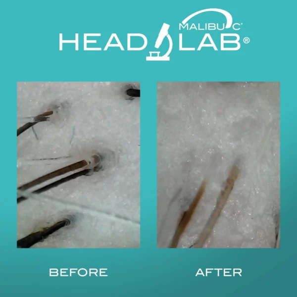 Scalp camera ukiah hair salon