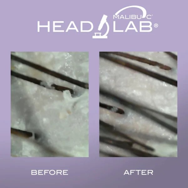 a before and after showing a congested scalp zoomed way in so you can see the follicle. it has a putple frame and says head lab